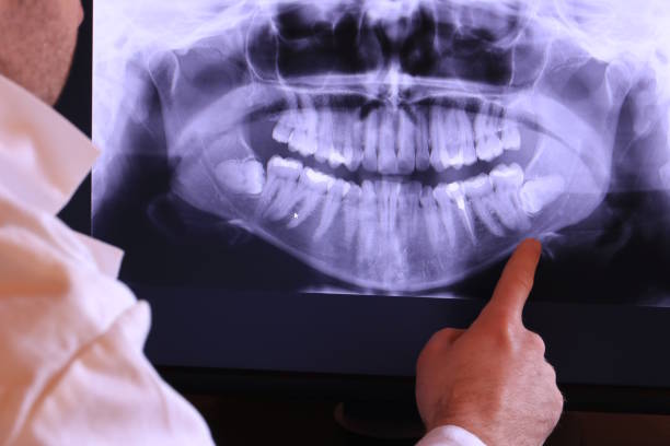 Best Emergency TMJ Treatment in Memphis, FL